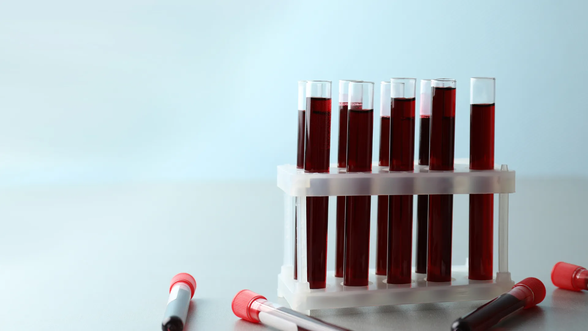 Blood sample tubes in the lab